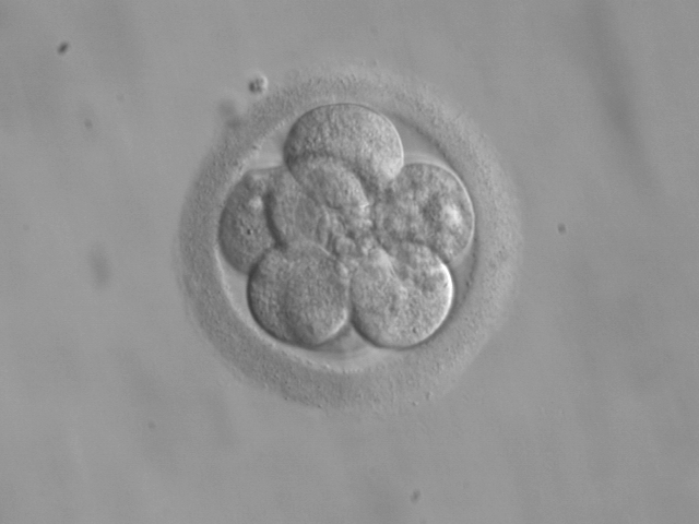 Ohio Court of Appeals Rules Embryos Are Not People in University Hospitals of Cleveland Case