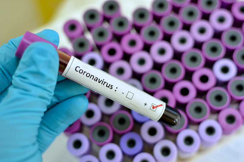 The Christ Hospital Closing its Mason Coronavirus Testing Site