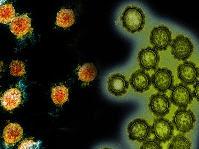 SARS-CoV-2, the virus that causes COVID-19 (shown in a colorized electron micrograph, left, in orange) may soon face off against influenza (H1N1 influenza virus particles in green, right) as seen in this composite image. Even scientists don't yet know how the encounter will end.